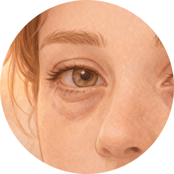 Puffiness
