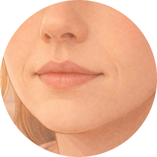 Nasolabial folds