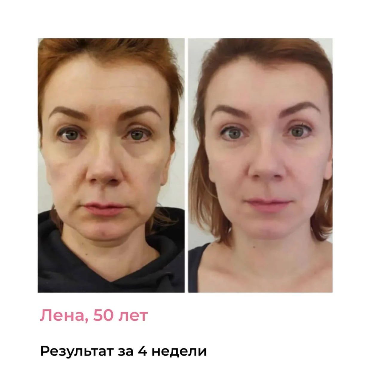 Результат: свежее лицо перед мероприятием