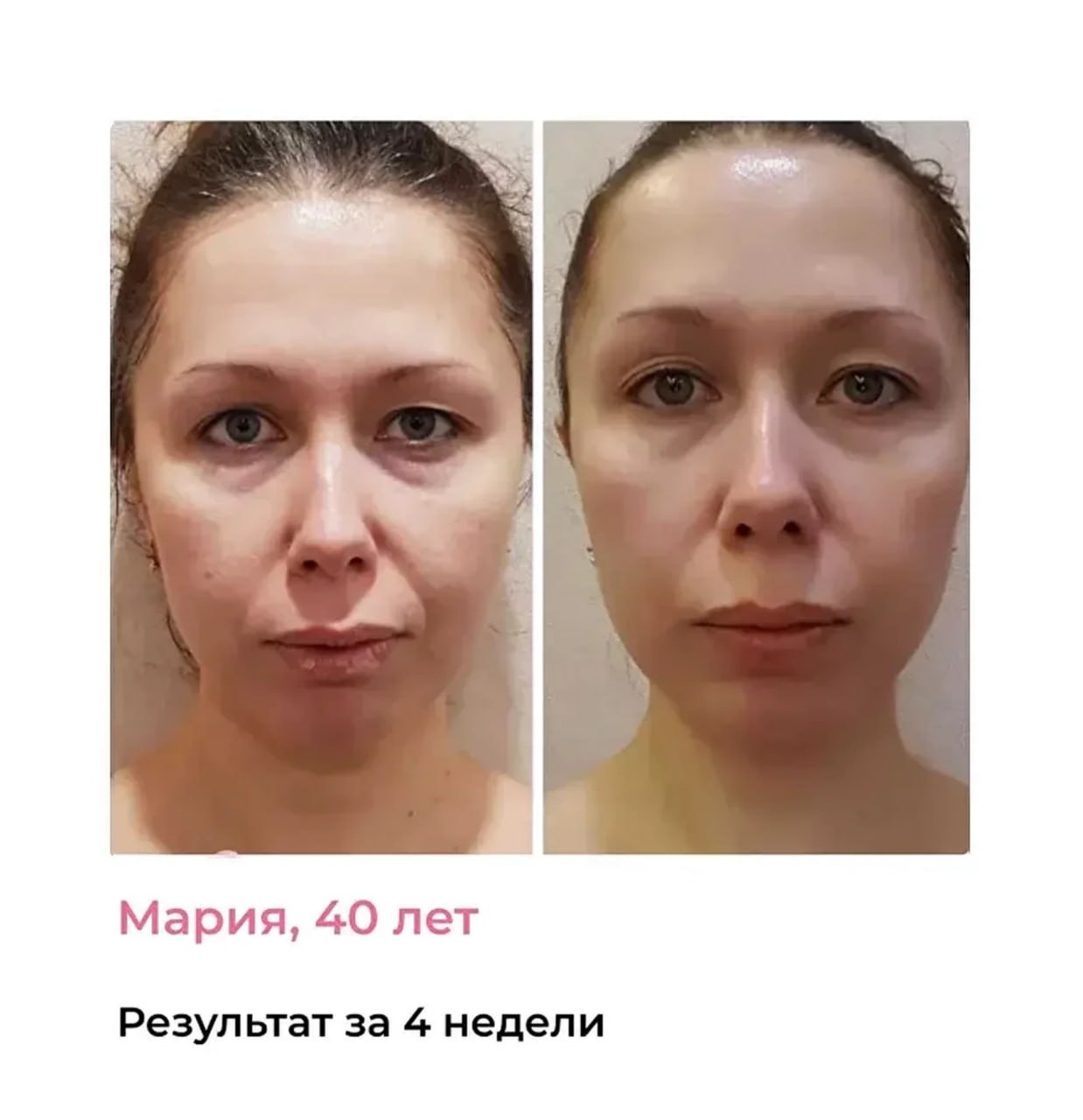 Результат: бархатная кожа