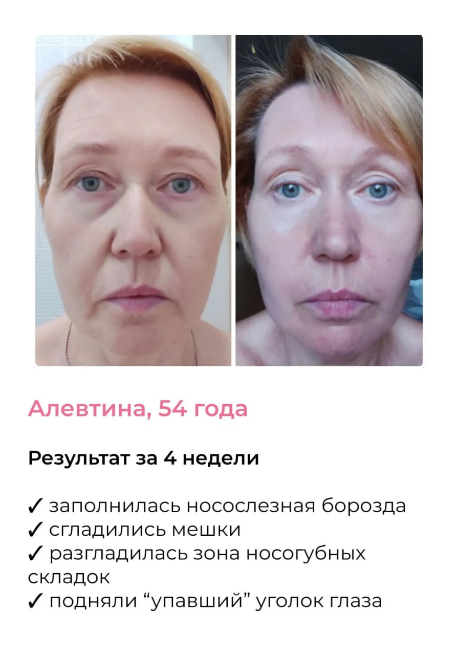 Результат участницы
