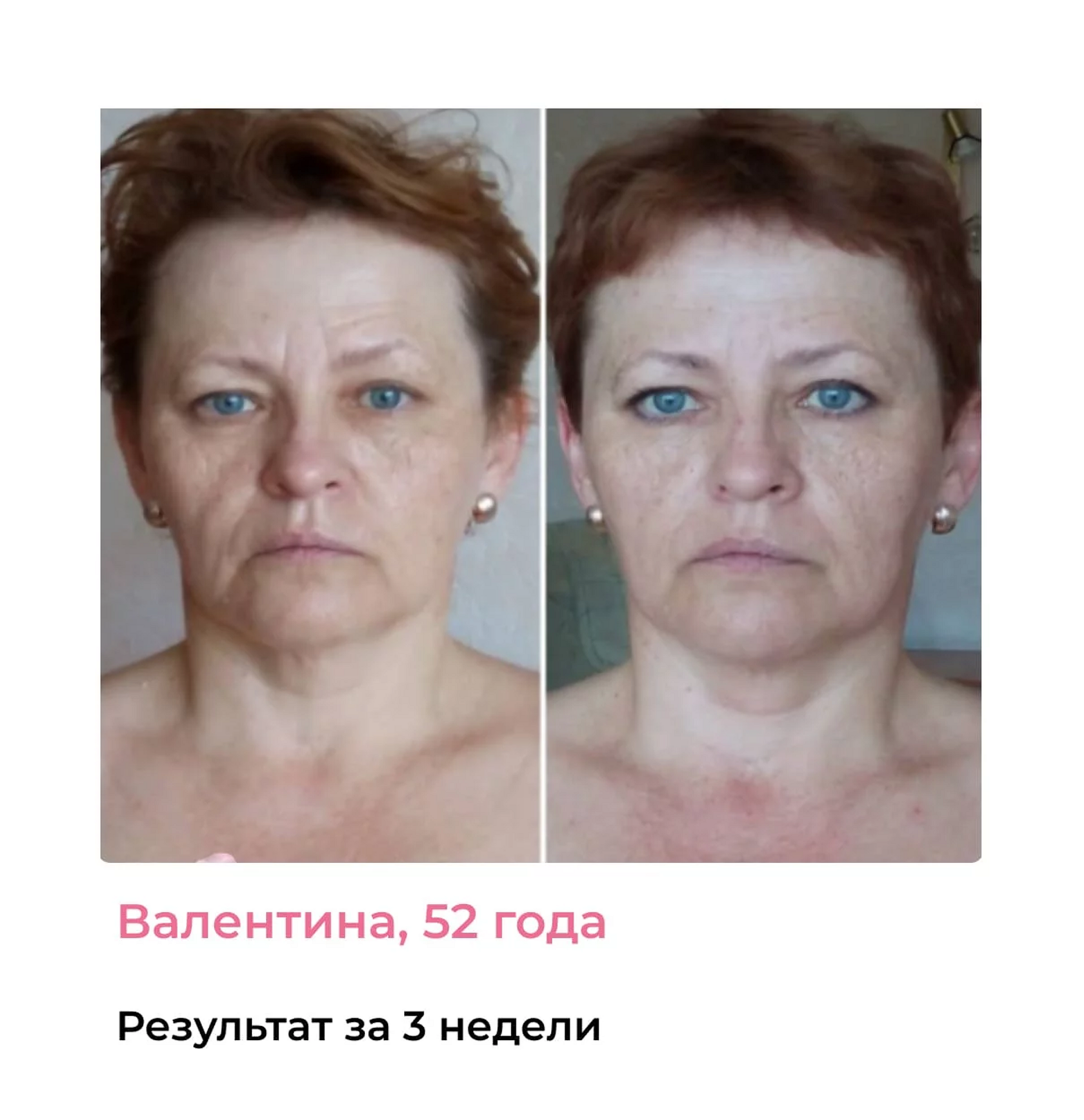 Результат до/после