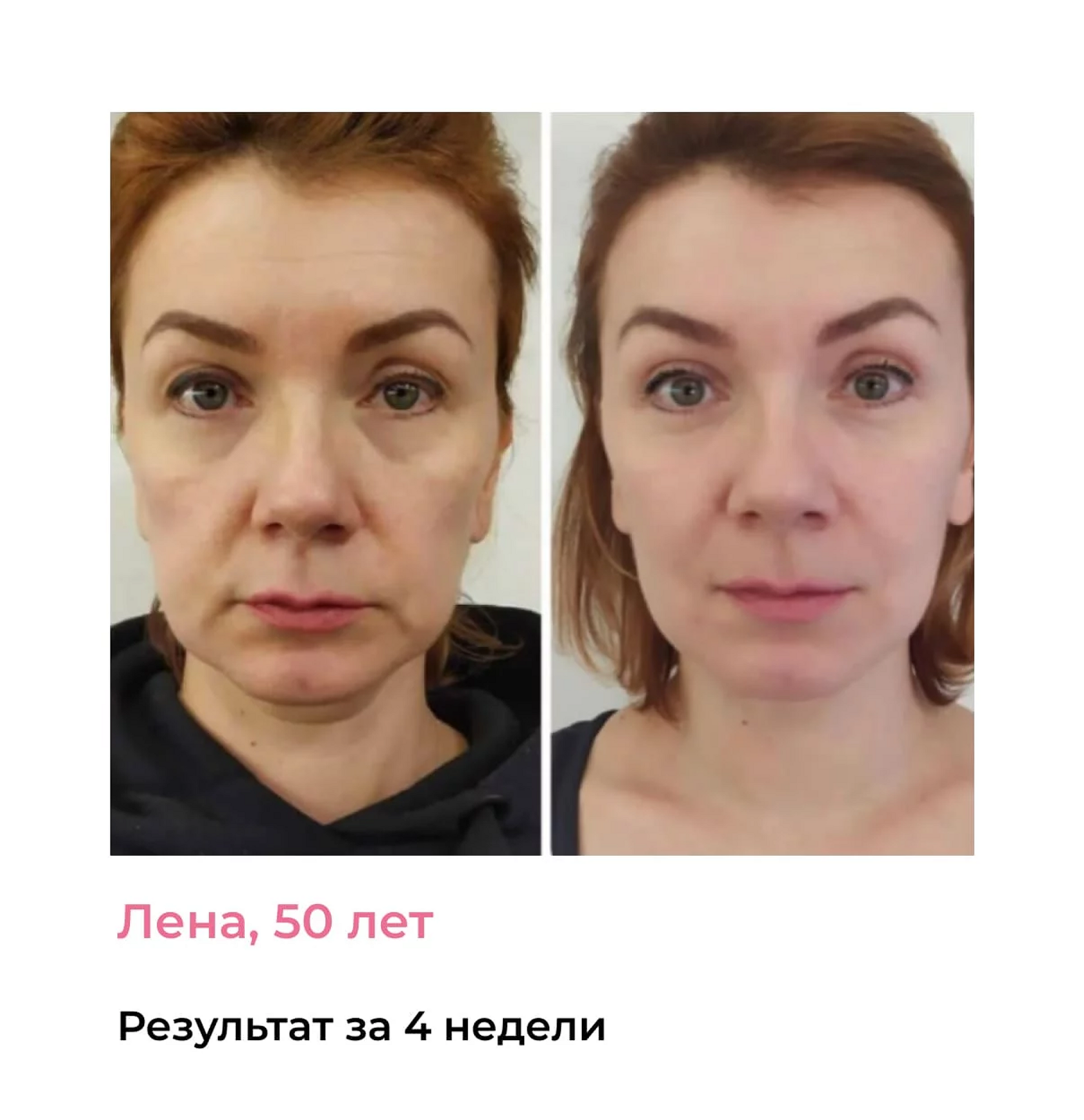 Результат до/после