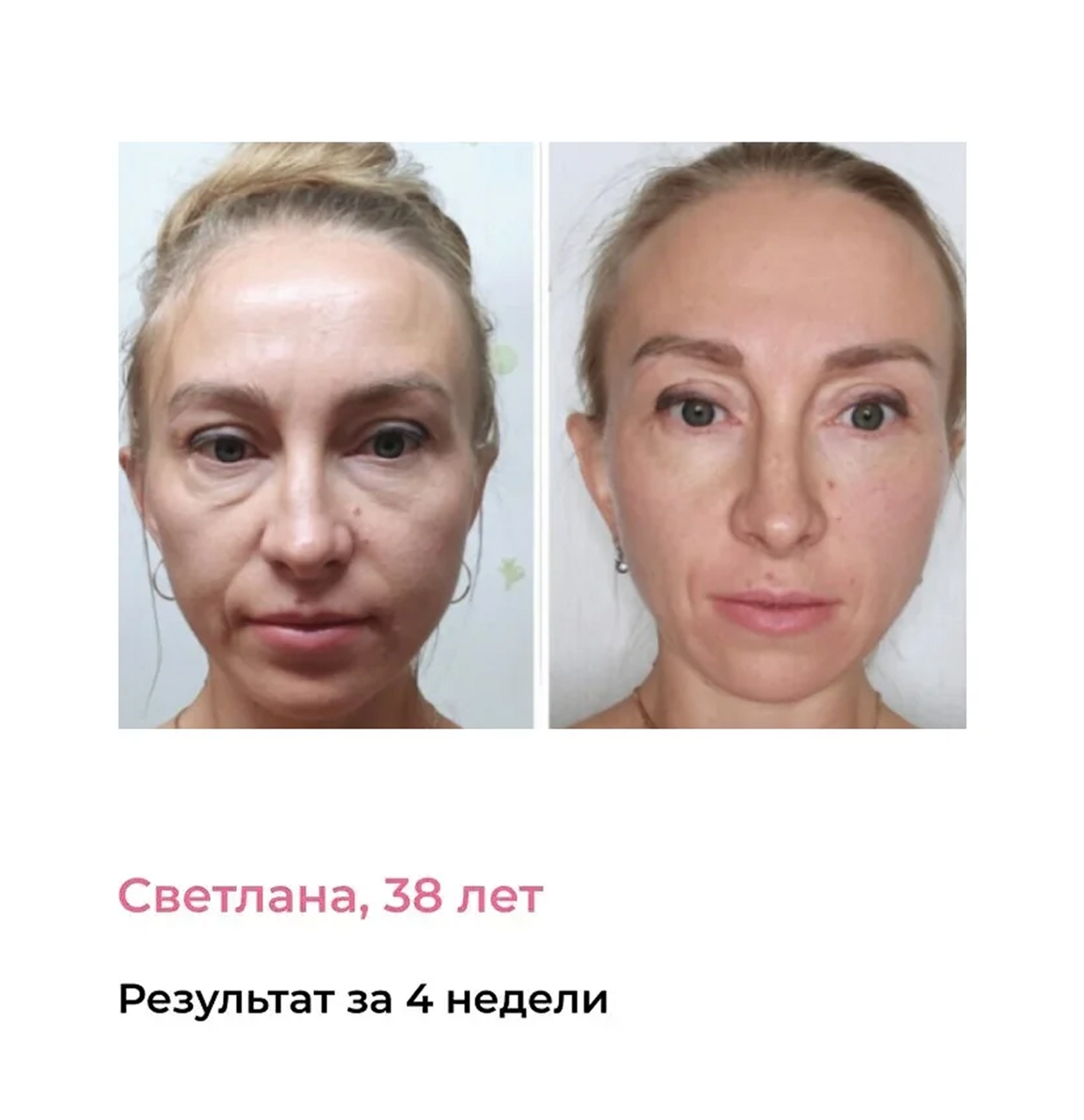 Результат до/после